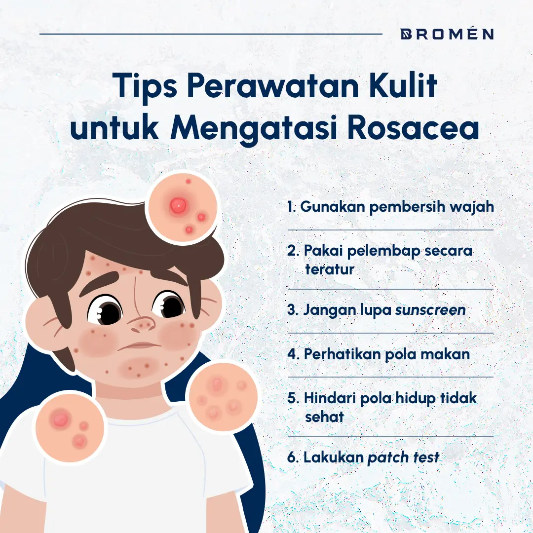 Tips perawatan kulit untuk mengatasi rosacea